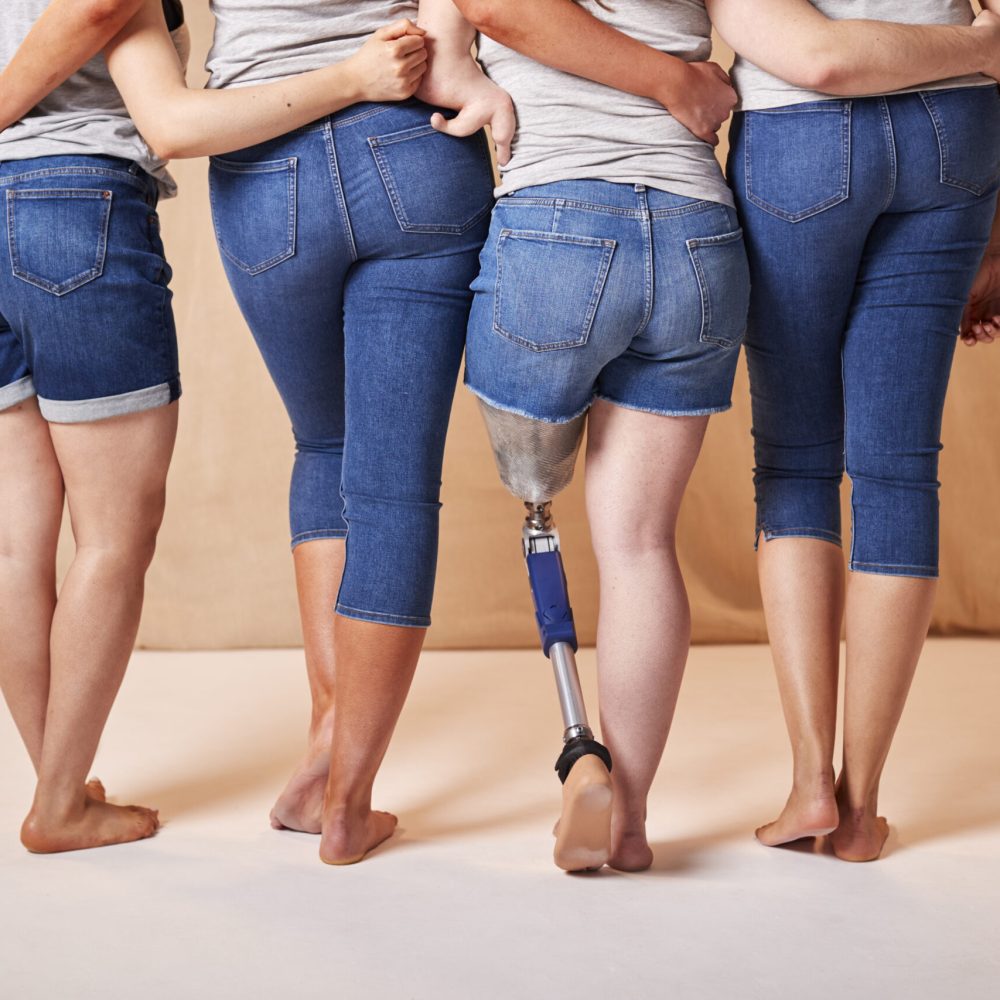Rear View Of Body Positive Diverse Casually Dressed Women Friends One With Prosthetic Limb